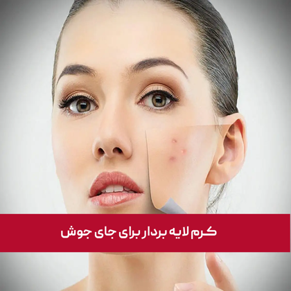 معرفی بهترین "کرم لایه بردار برای جای جوش" در سال 1404